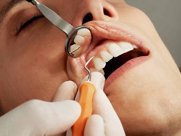 Pourquoi faire appel à un dentiste à Genève ?